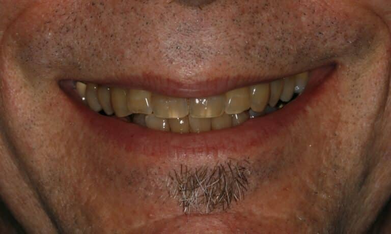 Konig Center for Cosmetic & Comprehensive Dentistry smile photos